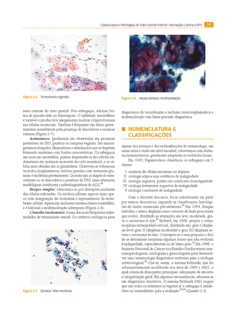 Colposcopia e Patologias do Trato Genital Inferior