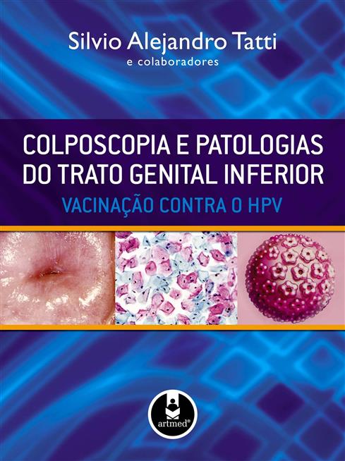 Colposcopia e Patologias do Trato Genital Inferior