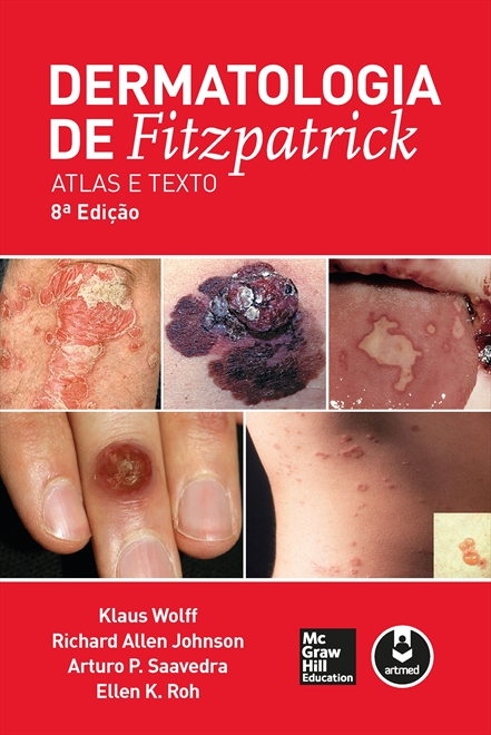 Dermatologia de Fitzpatrick