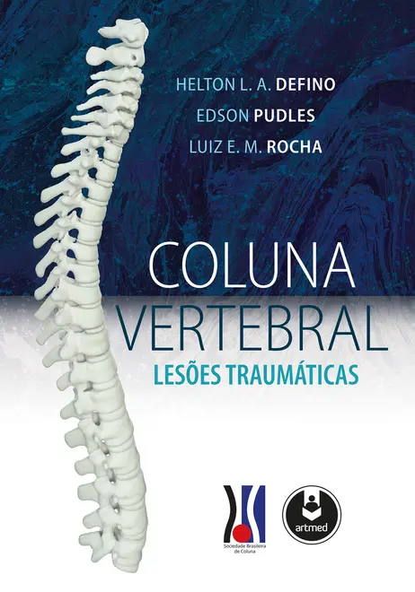 Coluna Vertebral