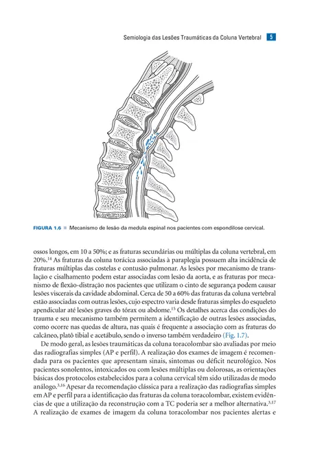 Coluna Vertebral