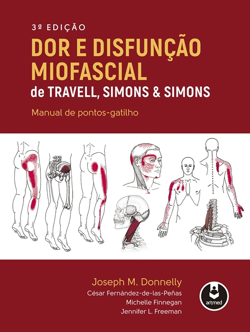 Dor e Disfunção Miofascial de Travell, Simons & Simons
