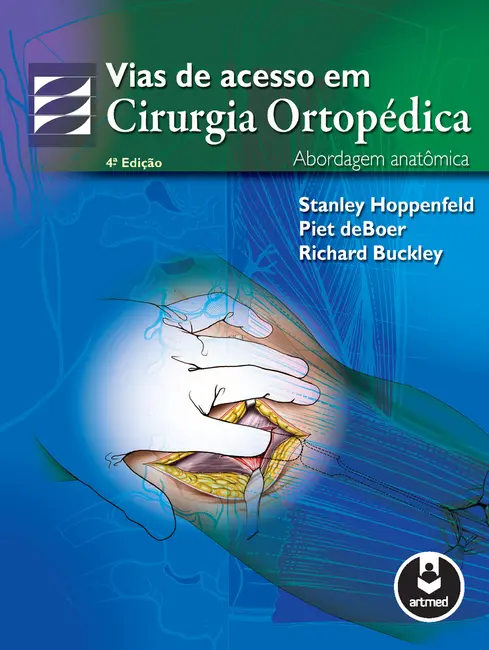 Vias de Acesso em Cirurgia Ortopedica