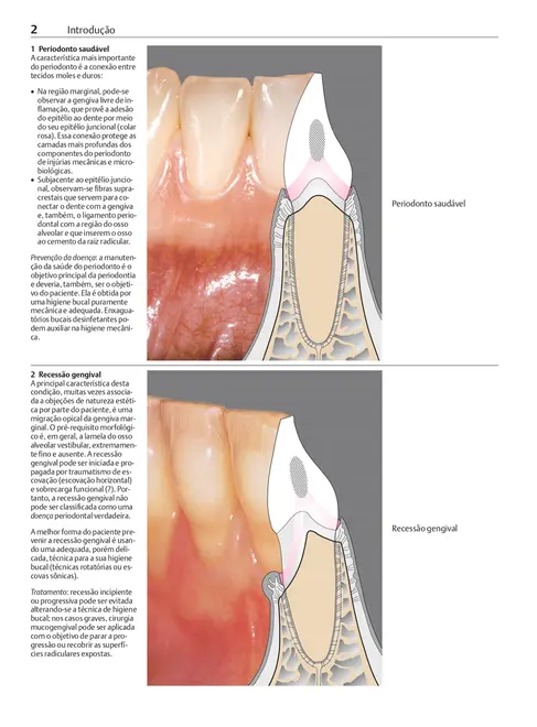 Manual de Periodontia