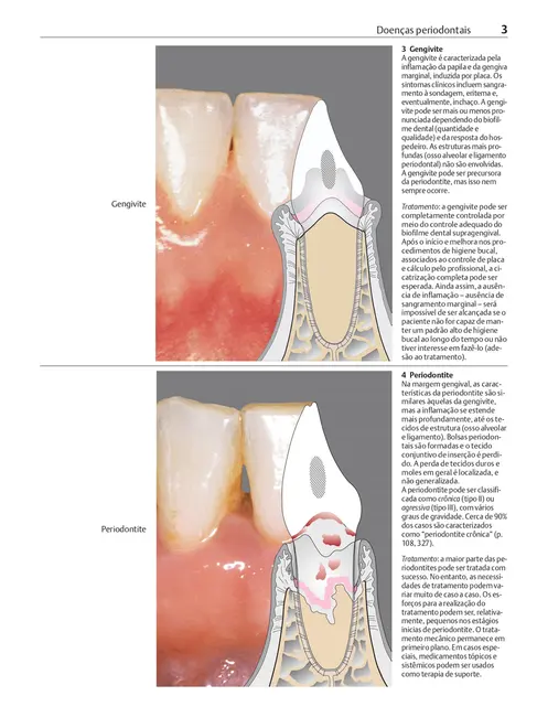 Manual de Periodontia