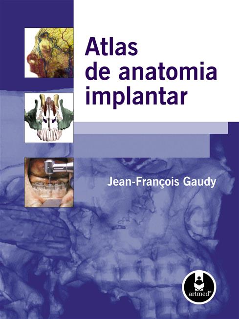 Atlas de Anatomia Implantar