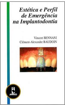 Estética e Perfil de Emergência na Implantodontia