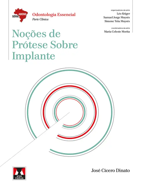 Noções de Prótese Sobre Implante