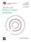 Noções de Prótese Sobre Implante