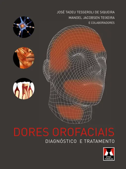 Dores Orofaciais