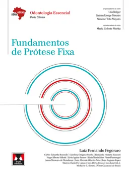 Fundamentos de Prótese Fixa