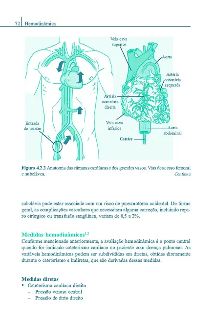 Tromboembolia Pulmonar