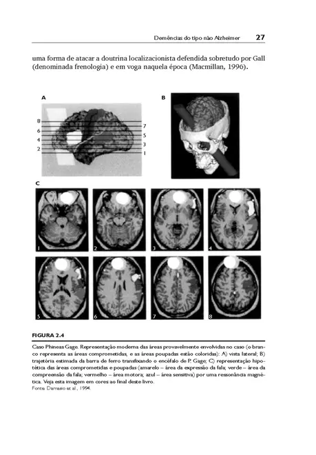Demências do Tipo Não Alzheimer